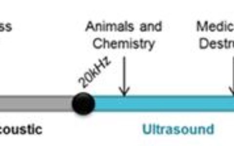 超声波避障传感器在哪些地方运用